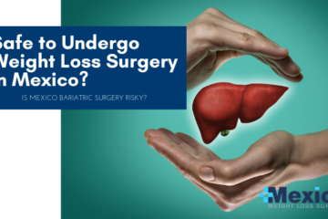 Safe to Undergo Weight Loss Surgery in Mexico