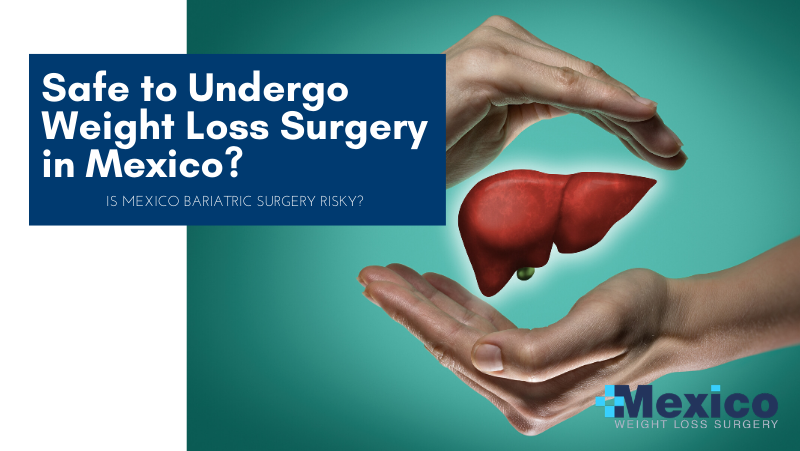 Safe to Undergo Weight Loss Surgery in Mexico