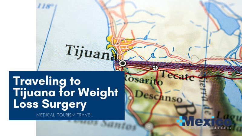 Traveling to Tijuana for Bariatric Surgery
