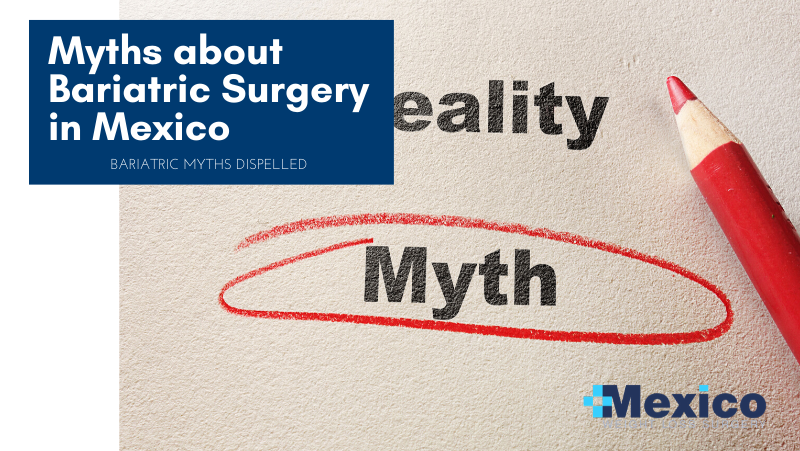 Myths Bariatric Surgery in Mexico