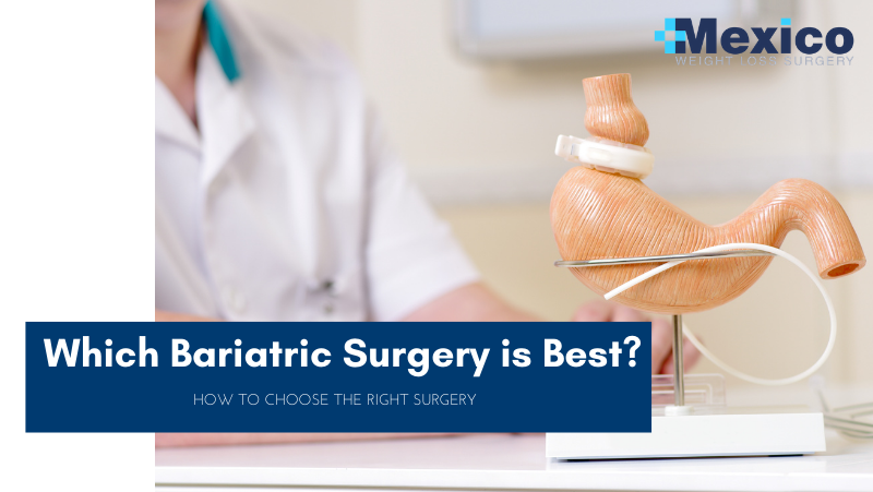 Which Bariatric Surgery is Best