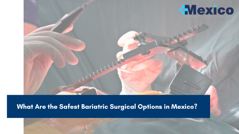 What Are the Safest Bariatric Surgical Options in Mexico?