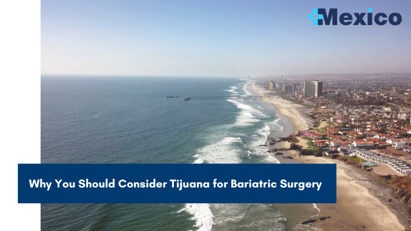 Why You Should Consider Tijuana for Bariatric Surgery
