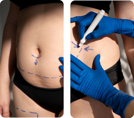 Blog-16-Image-2-Mexico-Weight-Loss-Surgery