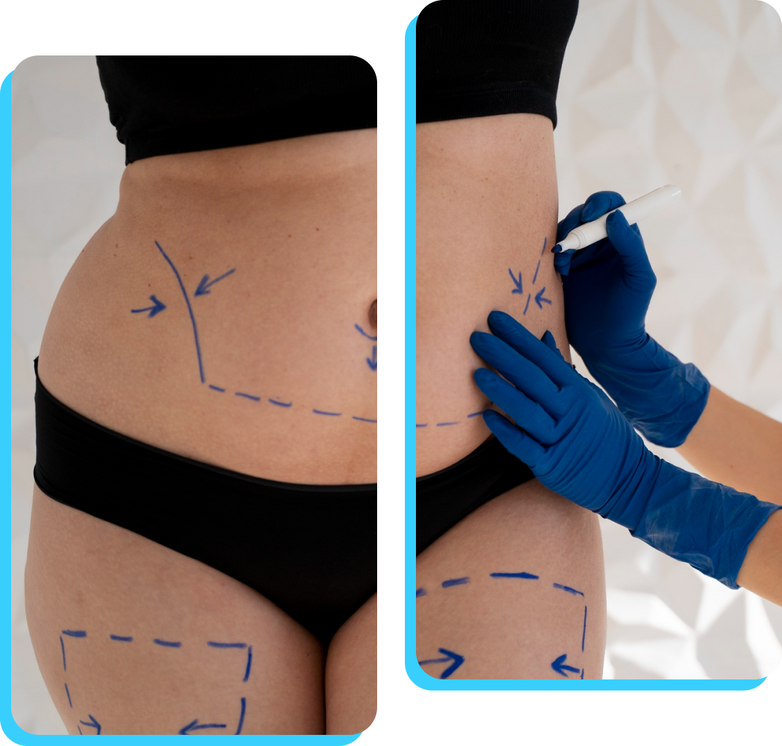 Blog-20-Image-2-Mexico-Weight-Loss-Surgery