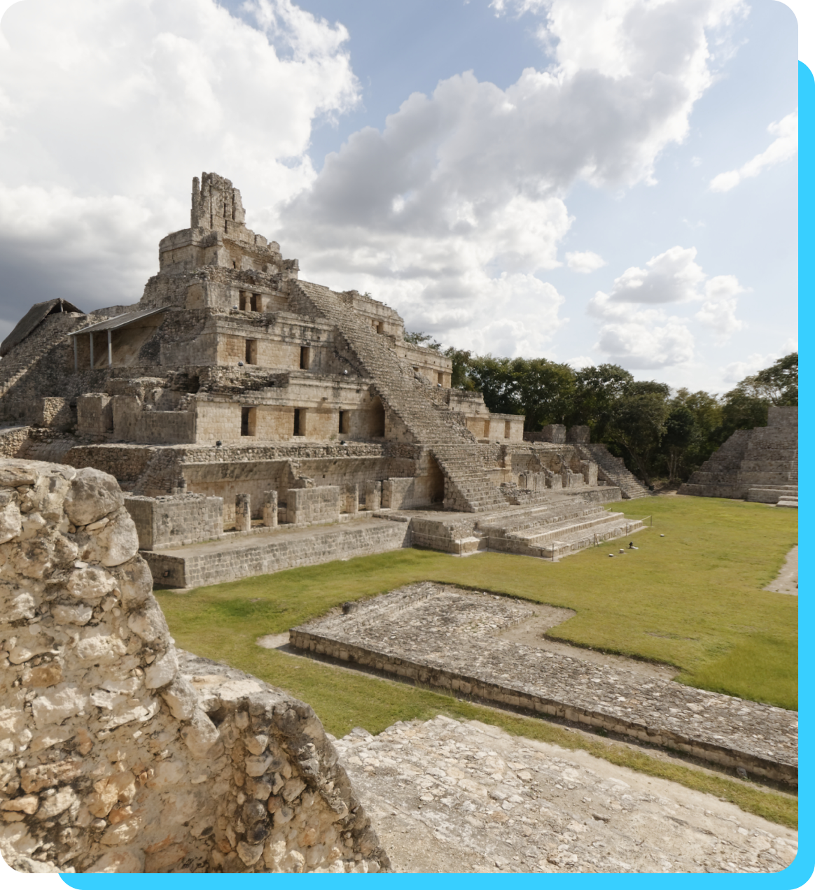Blog-27-Image-5-Mexico-Weight-Loss-surgery