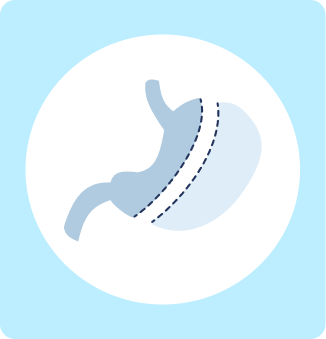 Blog-36-Image-5-Mexico-Weight-Loss-surgery