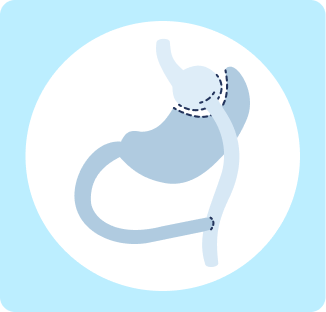 Blog-26-Image-5-Mexico-Weight-Loss-surgery