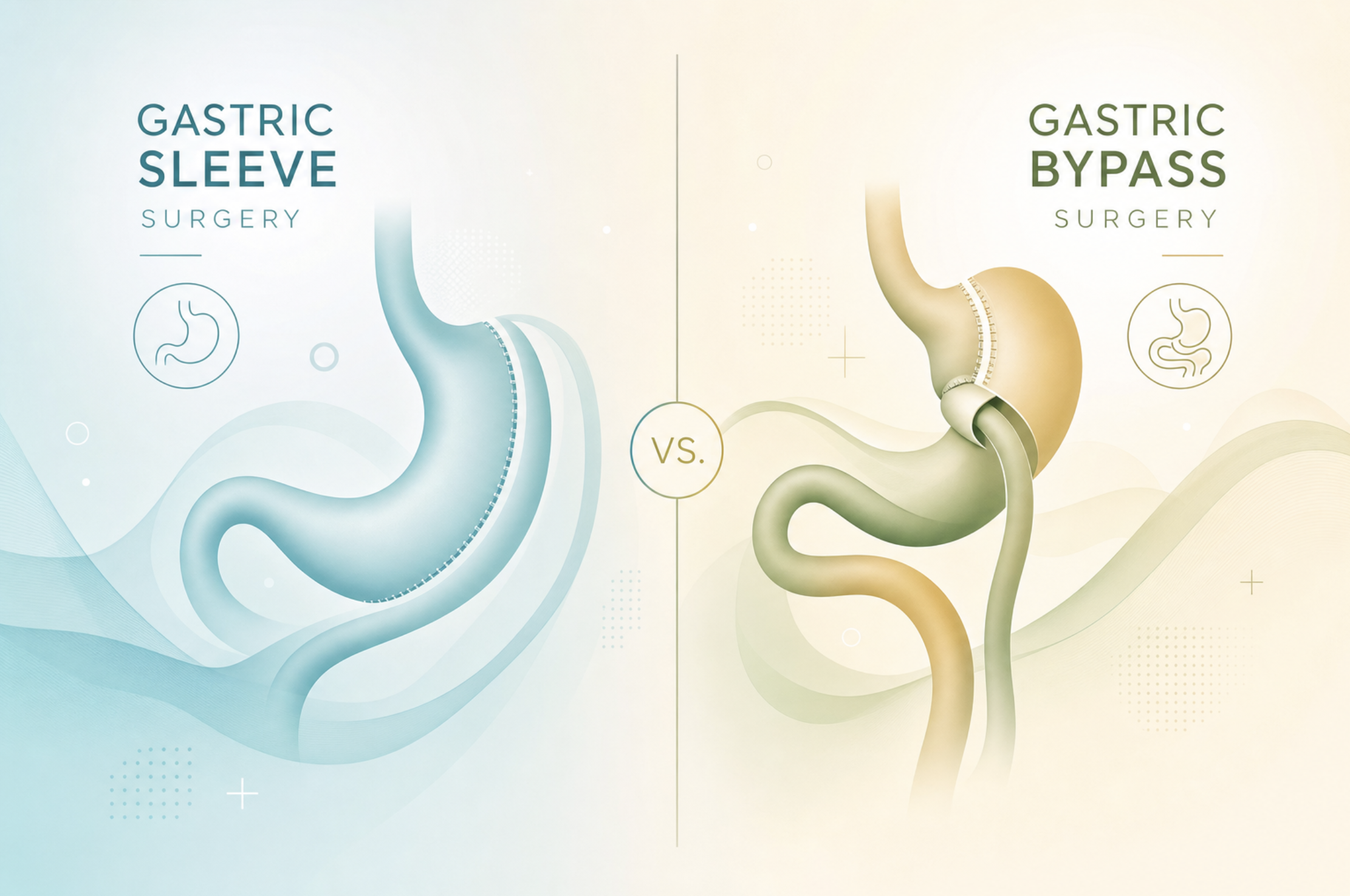 Gastric Sleeve vs Gastric Bypass